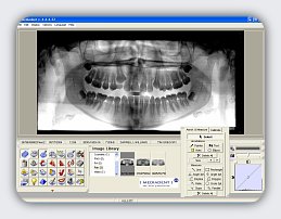 MDI Preview 1 ss_00_med