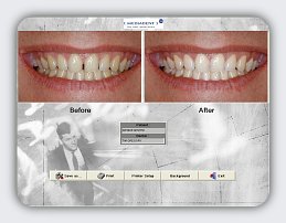 MDI Preview 3 ss_02_med