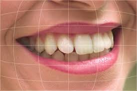 Digital Imaging